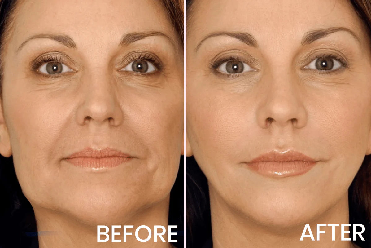 Advanced Firming & Wrinkle-Reducing Cream